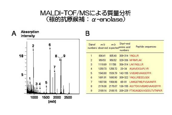 自己免疫性脳症のプロテオミクス解析 福井大学 ライフサイエンス支援センター 自己免疫性脳症のプロテオミクス解析 福井大学 ライフサイエンス支援センター